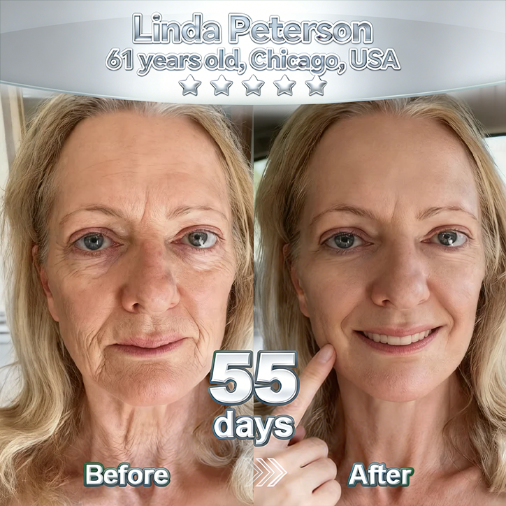 【𝐿𝑎𝑠𝑡 𝐷𝑎𝑦 𝑃𝑟𝑜𝑚𝑜𝑡𝑖𝑜𝑛 70% 𝑂𝐹𝐹】𝑷𝒖𝒓𝒆𝒍𝒖𝒙𝒐® Stem Cell–Inspired & GHK-Cu Powered Wrinkle-Refining Serum（Advanced Anti-Aging for Timeless, Radiant Skin）