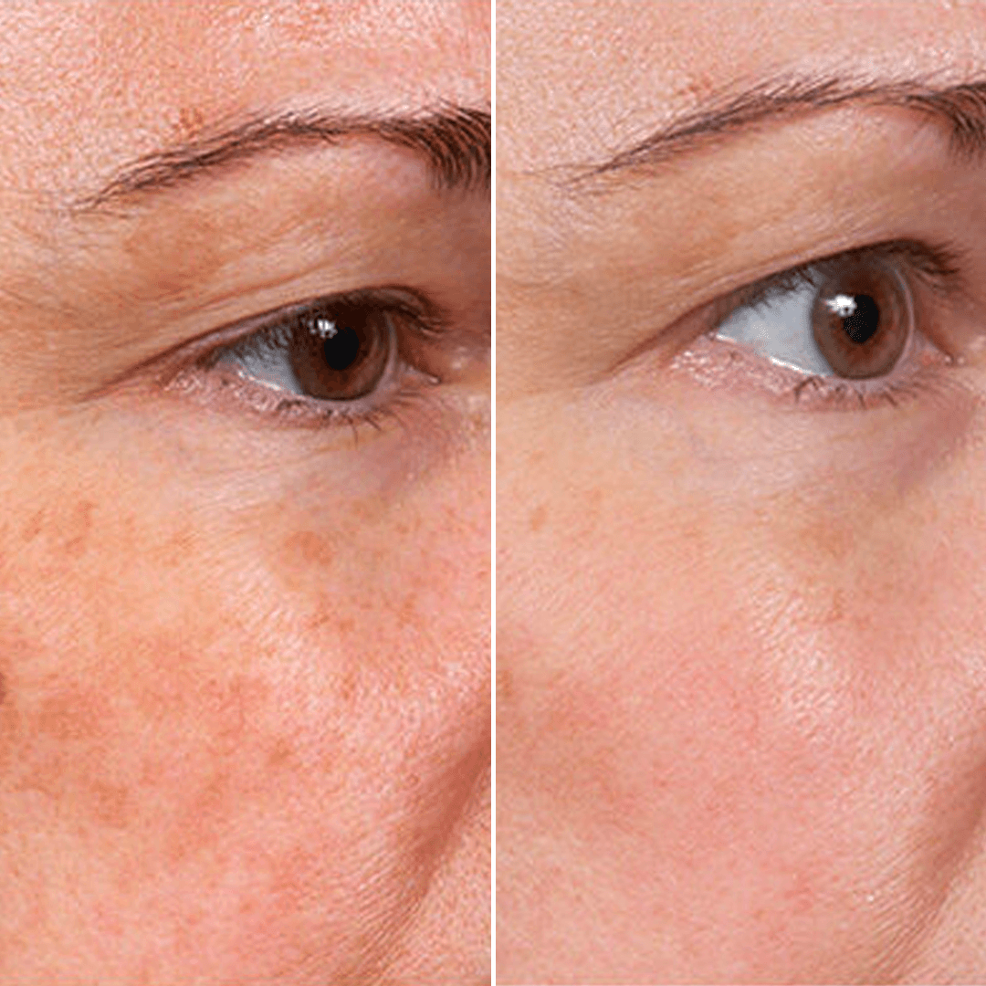 【𝐿𝑎𝑠𝑡 𝐷𝑎𝑦 𝑃𝑟𝑜𝑚𝑜𝑡𝑖𝑜𝑛 70% 𝑂𝐹𝐹】𝑷𝒖𝒓𝒆𝒍𝒖𝒙𝒐® Stem Cell–Inspired & GHK-Cu Powered Wrinkle-Refining Serum（Advanced Anti-Aging for Timeless, Radiant Skin）