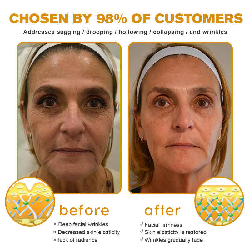 Official US Store 🇺🇸| Pureluxo® Advanced Skin Cream Daily Skin Care