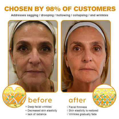 Official US Store 🇺🇸| Pureluxo® Advanced Skin Cream Daily Skin Care
